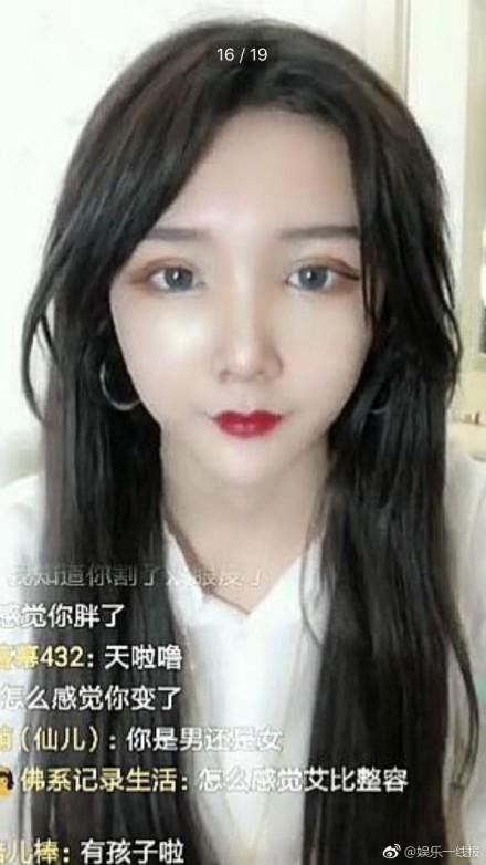 网红嘉欣整容爆料视频播放,网红整形风波视频播放量激增 第3张 网红嘉欣整容爆料视频播放,网红整形风波视频播放量激增 第3张